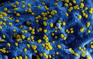 Nahaufnahme von Corona-Viren. Gelbe Viren auf blauem Hintergrund. Infektionen, besonders in Innenräumen, durch Corona-Viren.
